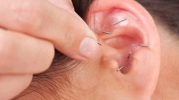 Auricoloterapia: un intervento per l’orecchio